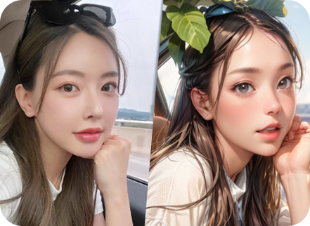 아이디병원 - 10대 눈성형 - 세미아웃으로 절개하지 않아도 포토샵 하지 않아도 원하는 라인 그대로 - 눈성형