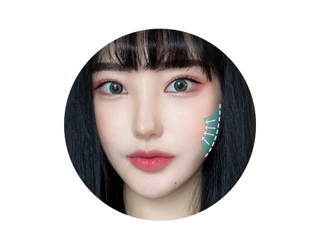 아이디병원 - id 광대축소 - 심부볼과 피하지방을 슬림하게 제거하여 더 갸름해지는 V라인 - 안면윤곽