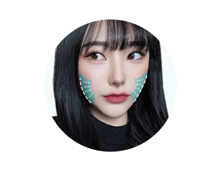 아이디병원 - id 사각턱축소 - 발달한 근육을 축소해 한 번 더 갸름하게 만들어 반영구적으로 확실한 효과- 안면윤곽